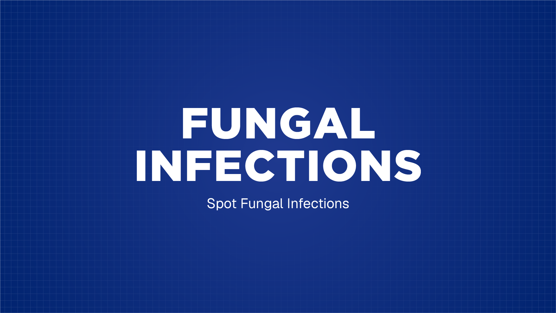 FUNGAL INFECTIONS